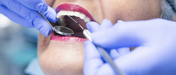 Best Emergency Root Canal Therapy in Paducah, TX